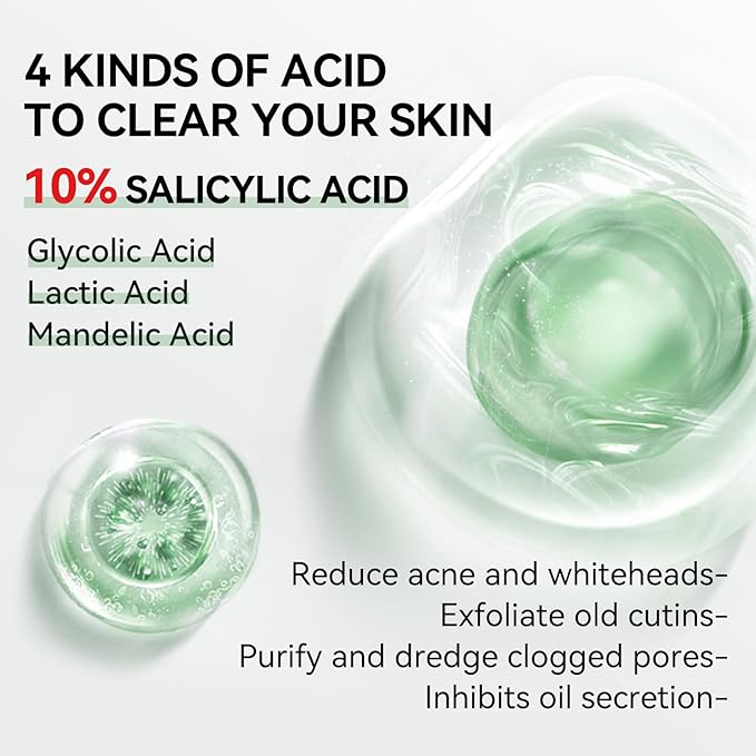 10% Salicylic Acid Serum, Acne Treatment for Face, 15ml/0.5oz, Minimize Pores, Active Skin Repair, Relieve Redness Blemish, Pimples Remover, Skin Barrier Repair for Acne Prone Sensitive Skin Care