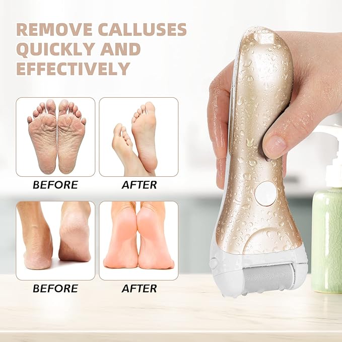 Callus Remover for Feet, Nicebirdie Electric Foot File Callus Removers Rechargeable Waterproof Pedicure Tools Foot Scrubber Shaver Feet Care Tool for Cracked Heels Dead Skin (Golden)