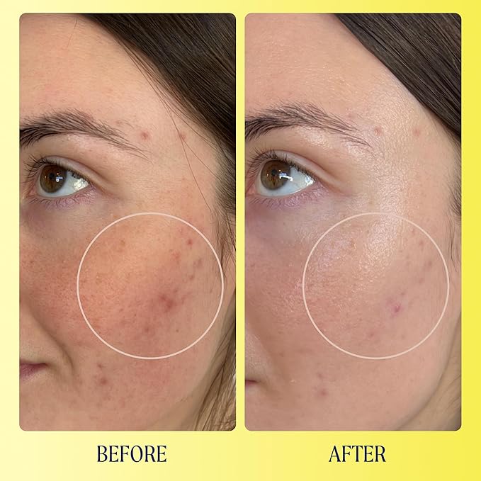 Kinship Brightwave 10% Vitamin C + Peptide Serum - Fade Dark Spots, Reduce Fine Lines & Wrinkles - Brighten, Plump & Smooth Face - Vegan Collagen - Anti-Aging Skincare - All Skin Types (1 Fl Oz)