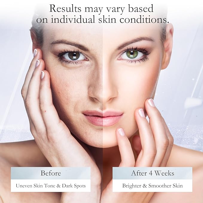 Dark Spot Remover for Face,Facial Dark Spot Remover for Sun Spots Age Spots Brown Spots,Body Dark Spots Remover Skin for Hands Underarm Legs (0.5 Fl Oz)