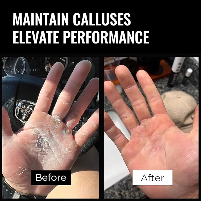 SandBar Callus Remover File for Hands - Durable Aluminum Tool for Callus Care and Dead Skin Removal - Includes Nourishing Salve - Ideal for Athletes, Climbers, and Gym Enthusiasts