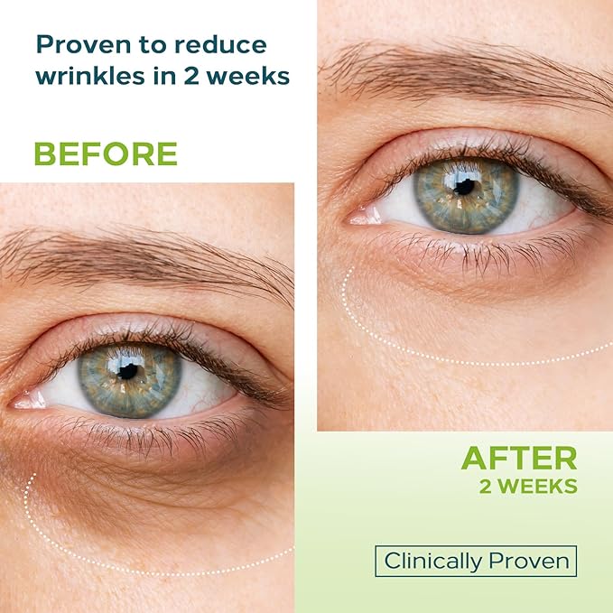 0.68 OZ Dual Eye Cream – Anti-Aging Blend with Stem Cells, Retinol & Peptides – Tightens, Brightens, and Smooths