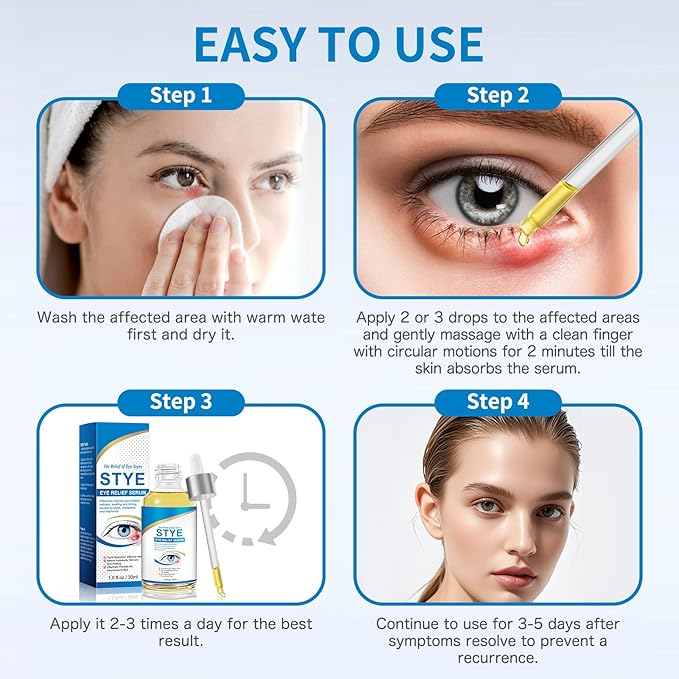 Stye Eye Treatment, Natural Stye Relief Serum for Styes, Chalazions and Blepharitis, Quickly Relieves Eye Irritation and Restores Healthier Skin