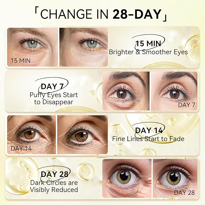 LANBENA 24K Gold Under Eye Patches(30 Pairs) -Cooling Eye Masks for Fine Lines Reduce, with Caffeine Niacinamide Tetrapeptide Hydra-Gel Collagen, Puffy Eyes & Dark Circles & Eye Bags Treatment
