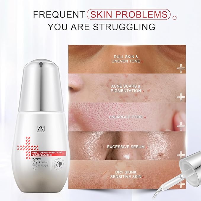 Niacinamide Serum 10%, 377 1% Dark Spot Corrector, Vitamin C Face Serum for Uneven Skin Tone, Pores Reducer, Facial Soothing Moisturizer, Korean Skin Care 30ml/1.01 fl. oz