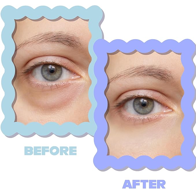 'SIRIUS'LY BRIGHT Under Eye Patches 28 Pairs, Reduce Dark Circles Puffiness Bags, Rejuvenate Eye Mask, Eye Gel Pads with Caffeine Boost, Hyaluronic acid, Iris Moss Extract, Gifts for Women and Men