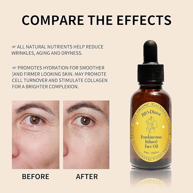 Frankincense Resin Oil For Face,Frankincense Resin Infused Organic Black Seed & Jojoba Oils,Natural skin Care moisturizing, Facial Anti-Aging Moisturizing skin Serum (2)
