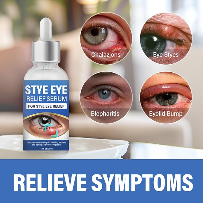 ITECFREELY Stye Eye Treatment, Natural Stye Eye Relief Drops Serum for Styes Chalazion and Blepharitis, Fast Chalazion Remover for Restore Healthier Skin-1 Fl.oz