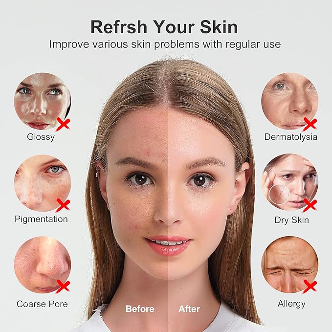 Newbealer Facial Steamer, Mini Aroma Face Steamer, Nano Ionic Hot Mist Face Humidifier for Facial Deep Cleaning, Home Sauna Spa Sprayer with 9 Pieces Acne Remover Kit (Blue, 160 ml)