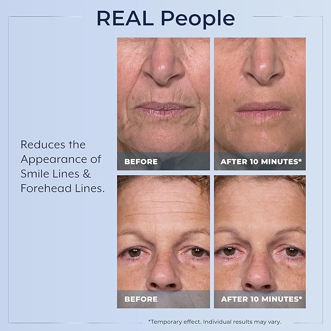 Plexaderm Rapid Reduction Eye Serum - Visibly Reduces Under-Eye Bags, Wrinkles, Dark Circles, Fine Lines & Crow's Feet Instantly, Anti Aging Wrinkle Remover for Face, 3 Full Size Tubes