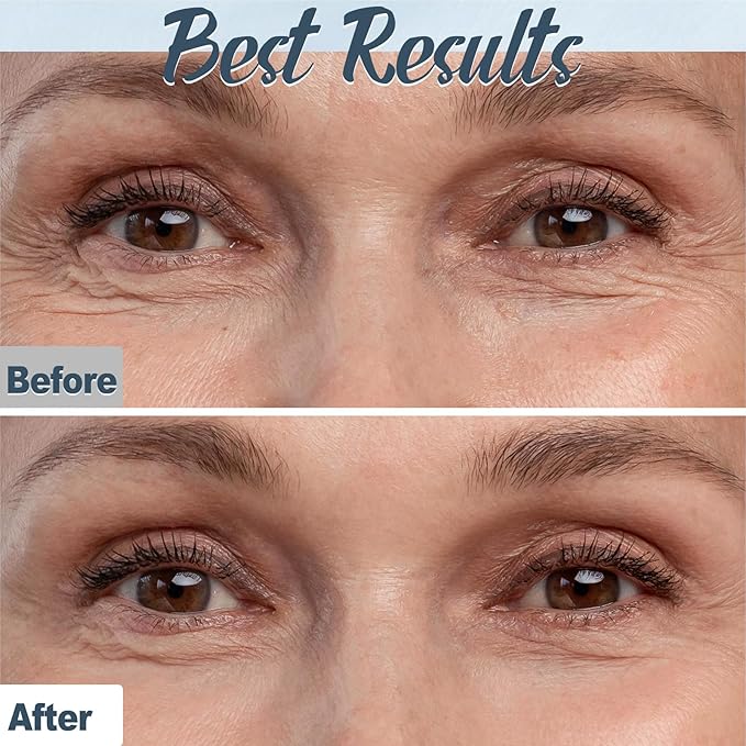 Natural Eye Cream- 26Pcs DIY Eye Cream Making Kit, Under Eye Cream for Wrinkles and Bags Skin Care Treatment with Vitamin E, Shea Butter, Anti Aging Eye Cream, Make Your Own Eye Cream for Women