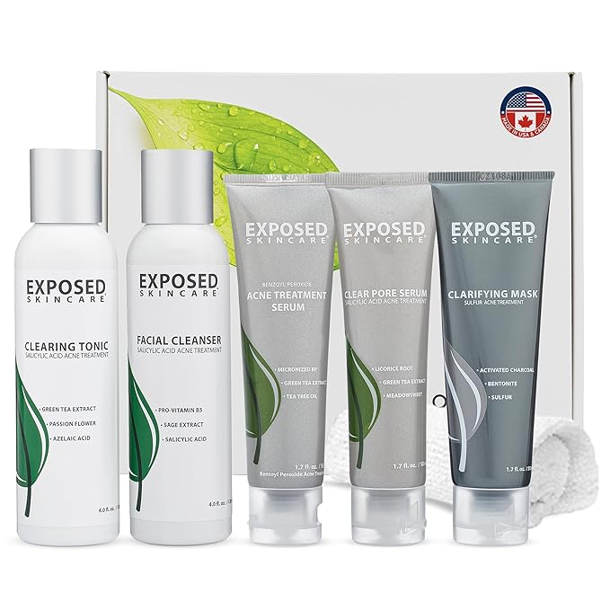 Exposed Skin Care Acne Treatment Kit - Includes Facial Cleanser, Clearing Tonic, Acne Treatment Serum, Clear Pore Serum, Clarifying Mask, Cloth - Natural Acne Solution for Face, All Ages & Skin Types