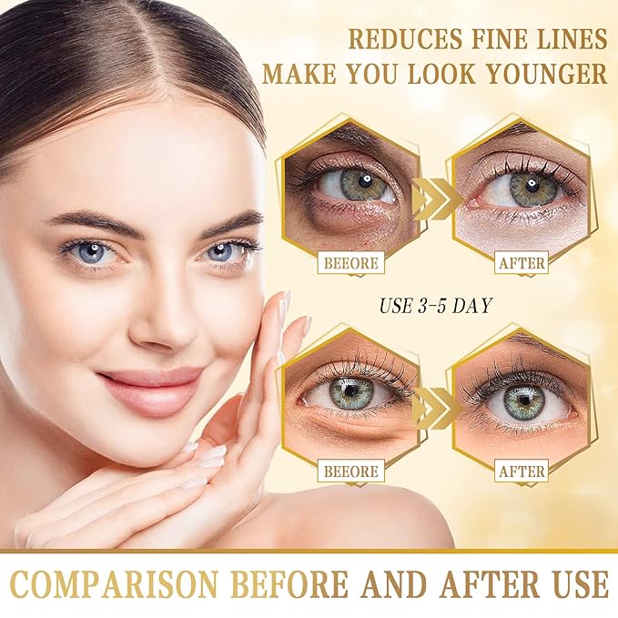 Danvisit 60 Pcs Under Eye Patches: 24K Gold Eye Masks for Dark Circles and Puffiness Anti-Aging & Rejuvenating Hydrogel Eye Patch