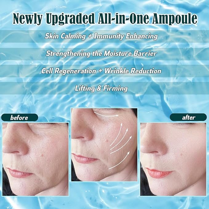 Hydro Ampoule-Korean Skin Care Serum for Microneedling Serum Ampoules for Face Starter Kit,dry effectivelyAll-purpose ampoule for Sensitive skin