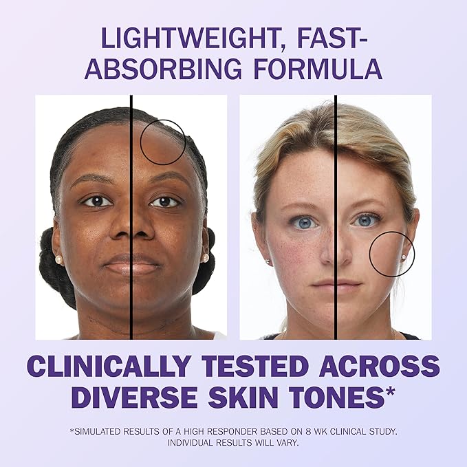 Olay Super Serum - Vitamin C & E, Niacinamide, Collagen Peptide, AHA - Glass Skin Care for Face - Brightening, Hydrating, Firming, Evens Tone, Smooths Fine Lines, Dark Spot Reduction, 1.0 Oz