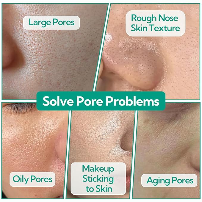 Pore Minimizer Serum, BREYLEE Pore Refining Serum for Face & Nose, Oil Control Firming, Shrinking Pore & Tightening Skin, Pore Moisture after Blackhead Remover, Clam and Soothing Skin Care