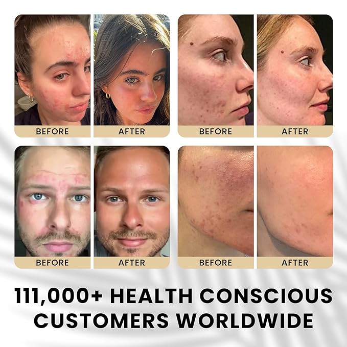 Alitura Hyaluronic Acid Anti-Aging Night Cream – Hydrating Face Moisturizer with 10% Hyaluronic Acid & Superfoods – Wrinkle Cream for Women & Men – Anti-Wrinkle Night Cream for Radiant, Youthful Skin