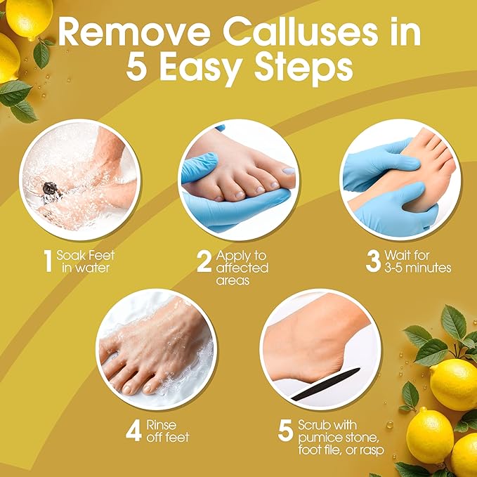 DeEnti Callus Remover for Feet, Extra Strength Foot Callus Remover Gel, 8oz Salon Grade Home Pedicure Supplies for Dry Skin, Cracked Heel, Professional Strength Foot Care, Lemon