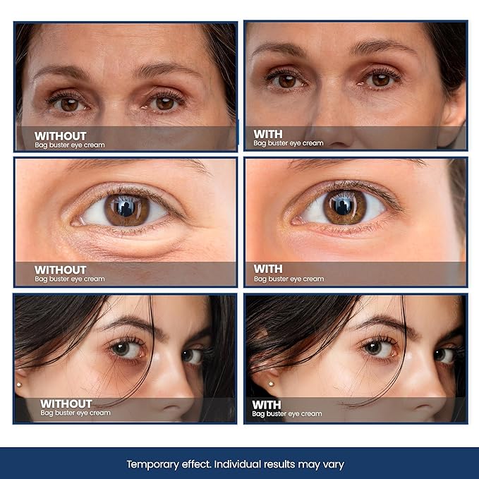 Bag Buster Eye Cream - CPR Repair Eye Cream | Eye Cream for Puffiness and Bags Under Eyes