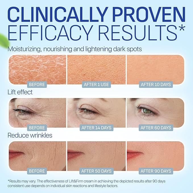 Face & Neck Cream for Tightening and Firming - Hyaluronic Acid 4D, Vitamin E + B5, Elastin - Made in Europe - Lift & Firm Cream - Face Moisturizer Anti Aging Treatment for All Skin