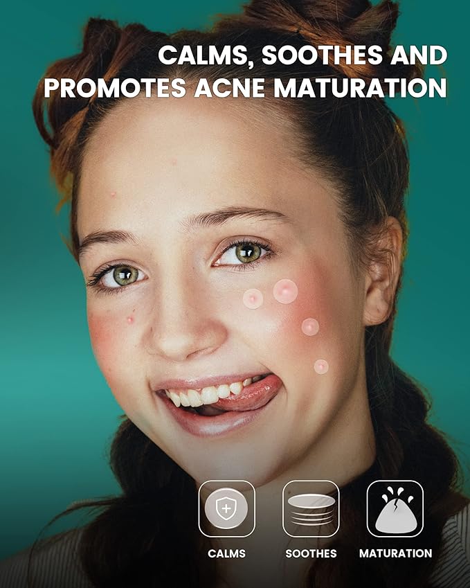 Pimple Patch 420 Counts 4 Sizes, Hydrocolliod Acne Patch for Face, Invisible Zit Patch with Tea Tree Oil & Calendula Oil, Blemish Patch, Vegan and Cruelty Free