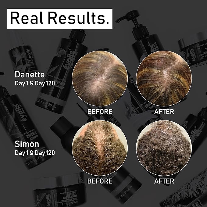 EVOLIS Promote Nourishing Treatment Mask - Deep Conditioning Hair Mask to Support Hair Growth - Hydrating Hair Mask for Dry, Damaged Hair - Travel Size (1 fl oz)