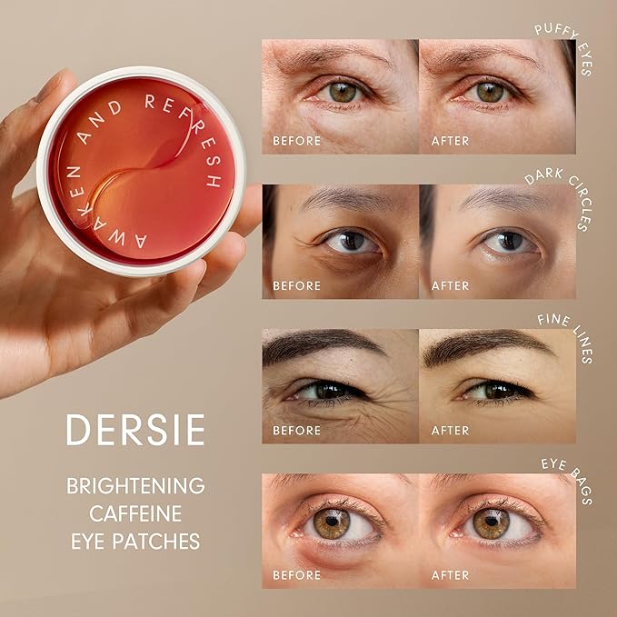 Dersie Eye Patches for Puffy Eyes and Dark Circles: Reduce Puffiness and Dark Circles - Brightening Caffeine Eye Patches with Hyaluronic Acid - Awakening and Hydrating (30 Pairs)