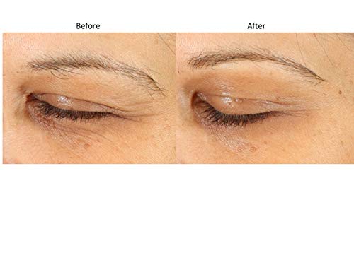 EyePlus+, a new formula powered by the ultimate trifecta of Methylene Blue, Ergothioneine, and Niacinamide. Dermatologist approved. Suitable for Sensitive Skin.