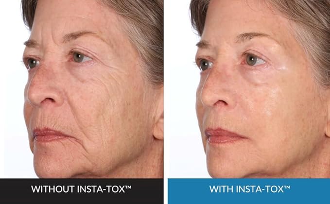 INSTA-TOX Facial Firming Wrinkle Smoothing Serum & Reverse Lift Firming Eye Cream Set - Tightener for Lines, Deep Wrinkles and Pores - Temporary Lift for Face and Eyes - Serious Skincare