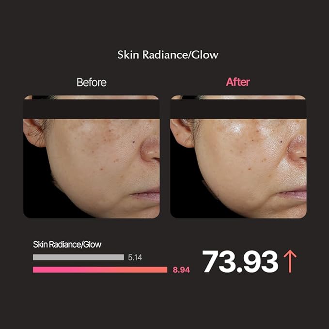 FaceFactory Boosters Pro – Anti-Aging Skin Care Device, LED & Galvanic, Glass Skin, Korean Skincare, Elasticity & Radiance, Lightweight & Safe for All Skin Types, Red Light Therapy