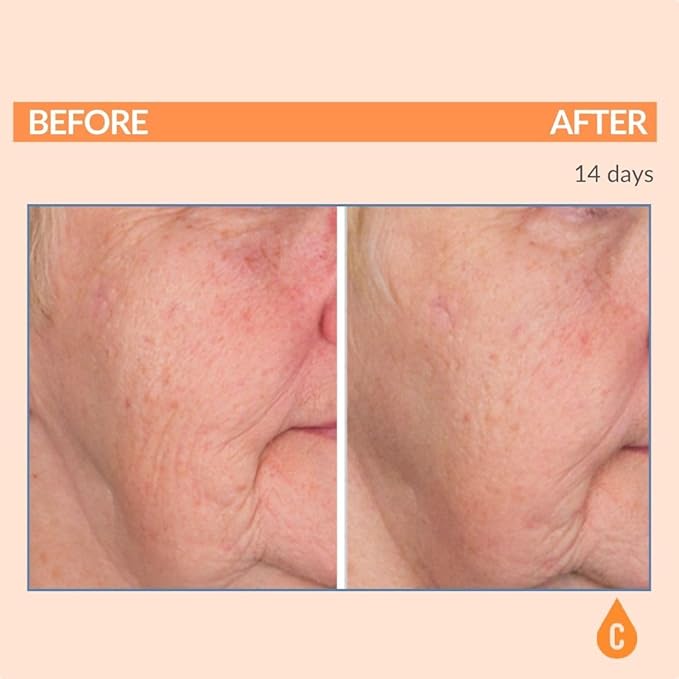 Serious Skincare Vitamin C & Collagen Skin Care Set - Reduce Wrinkles, Brightening - C-Restore Night Cream Moisturizer for Face, Eye Treatment Gel & C Clean Face Cleanser - Deep Hydration C3