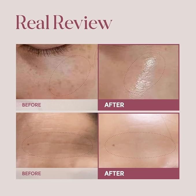 Reborn Cream with NK Cell Technology, Firming & Hydrating Facial Cream, 1.69 fl oz