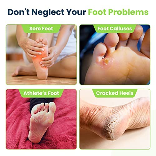 Tea Tree Foot Soak & Callus Remover Gel Kit - Extra Strength Callus Remover Gel & Foot Soak With Epsom Salts For Calluses & Tea Tree Oil Foot Cream - Moisturizing Athletes Foot Care For Dry Feet