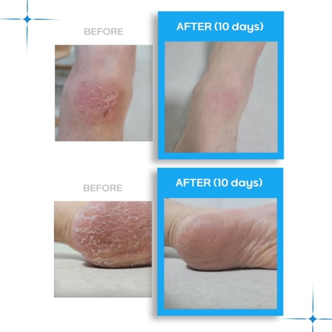 Organic Shea Butter Moisturizing Lip balm, Multi-purpose, Nourishing, Hydrating, Chemical-free, Non-toxic, Shea butter Scent (10, Grams), Dry Skin, Dryness, Korean