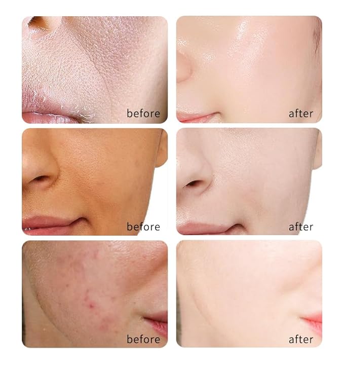 Antioxidants rich 20% Vitamin C Serum for Face with Glycolic Acid and Hyaluronic Acid -RED light therapy serum Boosts Collagen production, Fades Dark Spots, ANTI-AGING, nighttime use (9 serum in 1)