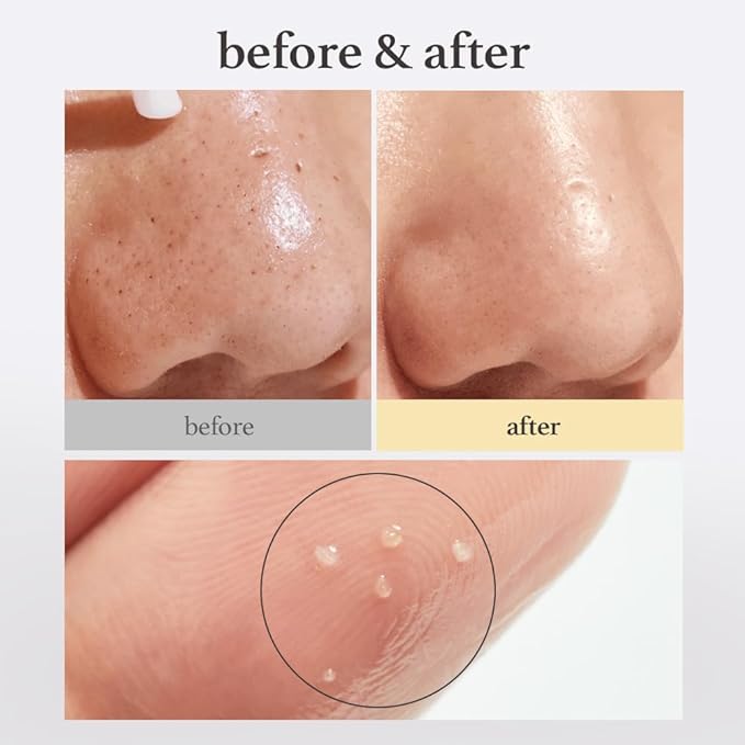 NOONI Facial Cleanser - Snow Aqua 0 LHA Toning Cleansing Oil | Makeup Blackhead Remover, Pore Control, Glass Skin, Help Control Sebum, Revitalizing, Mother's Day, 6.76 Fl Oz (200 ml)