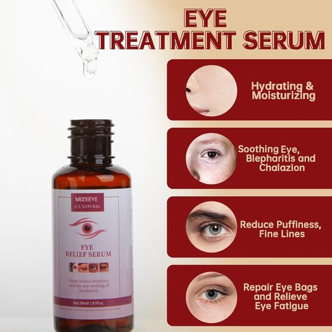 Chalazion Eye Treatment For Blepharitis, 30ml Moisturize Eyelids Serum and Chalazion Remover, Gentle Under Eye Relief Serum For Dark Circles, Eye Bags, Puffiness.