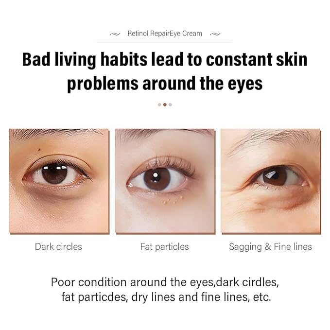 Retinol Repair Eye Cream，Reduces the appearance of dark circles，Stretch wrinkles at the corners of the eyes，moisturize and improve eye bags，Suitable for all skin types，1.05oz（2pcs）