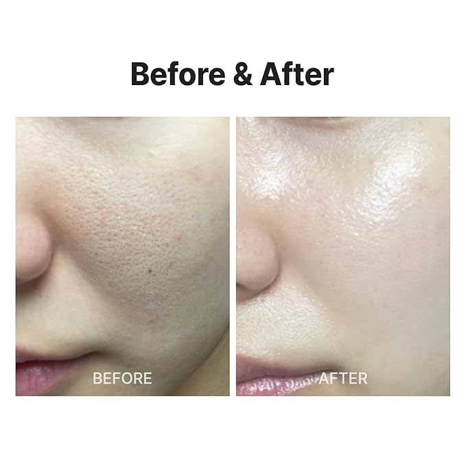 MEDITHERAPY Wrinkle-fit Tangle Eye Patch & Wrinkle-fit Face Mask - Under Eye Mask and Eye Cream for Eye Bags, Puffiness, and Dark Circles - Firming and Tightening Korean Collagen Mask