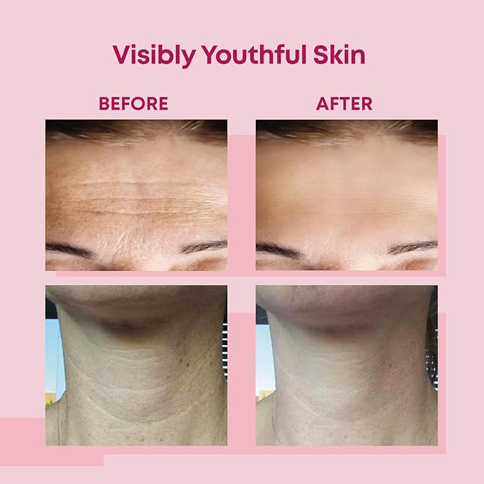 Bayside Forehead & Neck Wrinkle Patches Set | Hyaluronic Acid, Collagen & Vitamin E | Overnight Smoothing Treatment for Fine Lines & Wrinkles | Non-Invasive, Skin-Friendly Hydrating Care