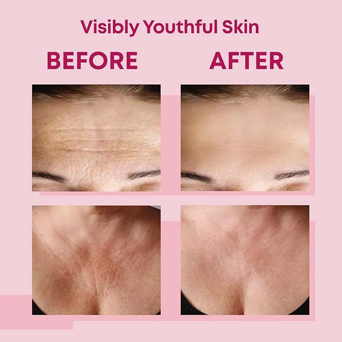 Bayside Forehead & Chest Wrinkle Patches Set | Hyaluronic Acid, Collagen & Vitamin E | Overnight Smoothing Treatment for Fine Lines & Wrinkles | Non-Invasive, Skin-Friendly Rejuvenating Care