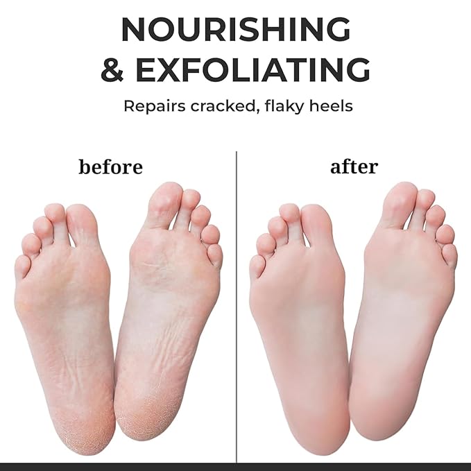 Happy Feet Foot Peel Mask, 03 Pack Original Exfoliant Foot Mask, Callus Remover for Rough Cracked Dry Feet Dead Skin, Gift for Mom Dad