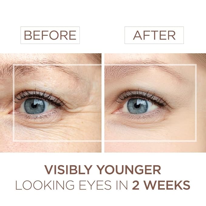 BEE and YOU Eye Serum, Anti Aging, Anti Wrinkle Serum 100% Natural with Bee Venom, Propolis Extract, Raw Honey, Hyaluronic Acid, For Dark Circles Under Eye Treatment and Puffiness, Skin Care, 15ml