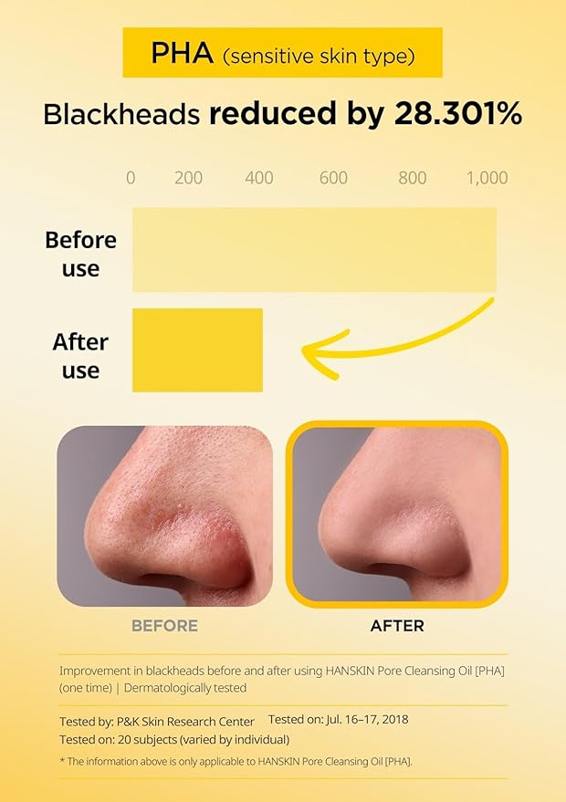 Hanskin Pore Cleansing Oil, Oil Cleanser for Face, Makeup Blackhead Remover, Korean Cleanser for Sensitive Skin [PHA] (10.14 oz)