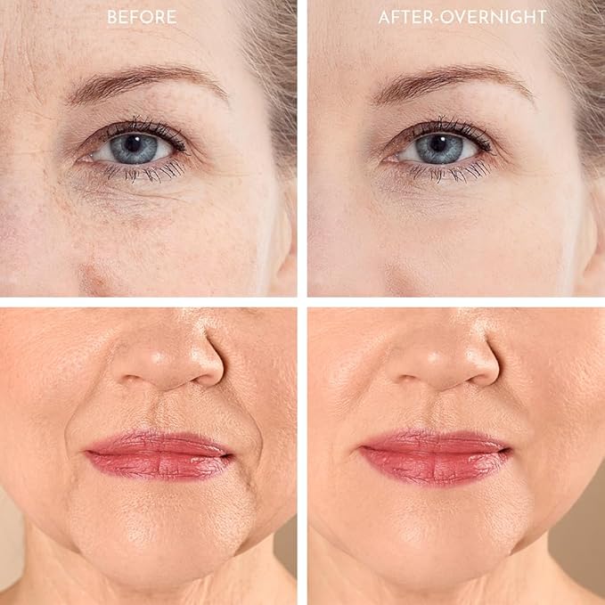 20X Reusable Expression Line Smoothing, Medical-Grade Silicone for Overnight Wrinkle Reduction & Anti-Aging Hydration, Beautify Brow Lift Forehead Anti-Wrinkle Patch