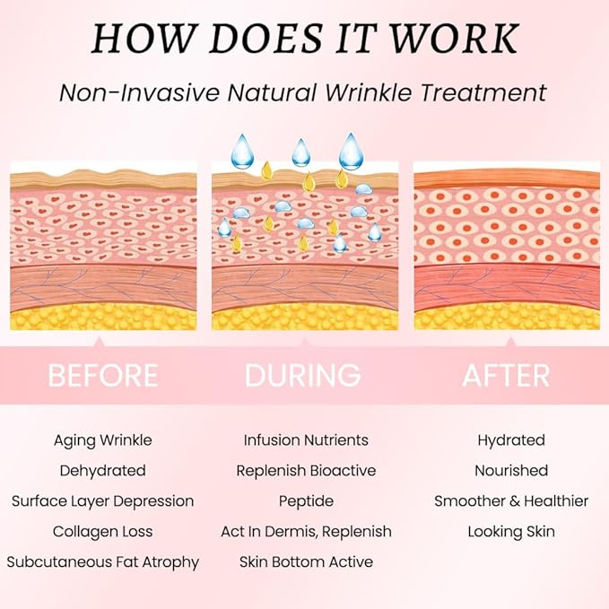 evpct 192Pcs Face Facial Medical Wrinkle Tapes Wrinkle Patches for Face Wrinkles Overnight, Smile Line Patches Face lifting tapes, Face oil Tape Smoothing Silicone face Forehead Wrinkle Patches