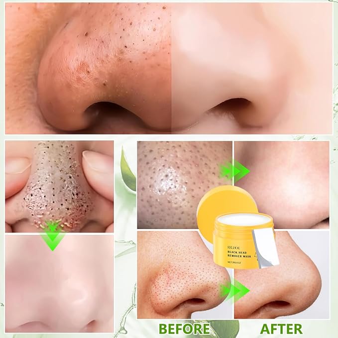 TQBAJ 2 Sets Pore Strips, Deep Cleansing Pore Strips, Blackhead Remover with 120PCS Strips, Nose Plants Pore Cleanser Purifying Face Mask for Nose and Face