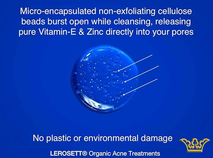 LEROSETT® Clear Skin Face Wash – Gentle Gel Cleanser with 60% Aloe-Rich Botanicals, 4% Glycolic Acid & Vit-E Microbeads – Fights Breakouts, Unclogs Pores, Balances Oil – Spa-Grade, Vegan – 4oz