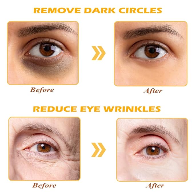 24K Gold Eye Mask, 30 Pairs Under Eye Masks for Dark Circles and Puffiness Treatment, Under Eye Patches for Puffy Eyes and Eye Bags, Gel Eye Mask Eye Pads for Face Skin Care