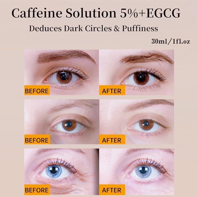 Caffeine Solution 5% + EGCG, Caffeine Eye Serum For Face, Moisturizing Under Eye Solution For Reduces Dark Circles & Puffiness, 30ML (1, 2PC)